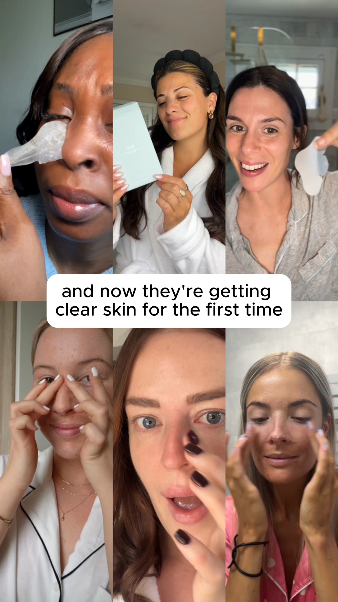 Stop Treating Blackheads Wrong