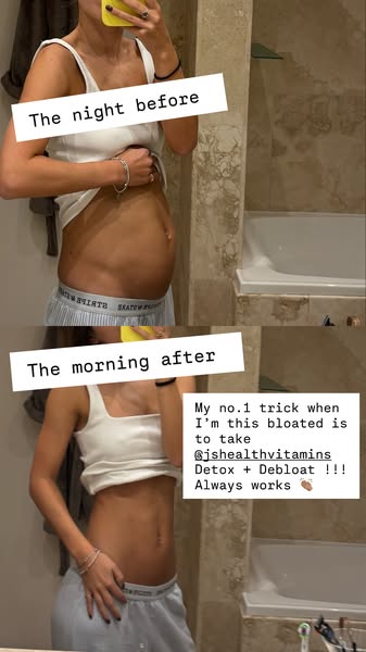 NUTRITIONIST-FORMULATED BLOATING SUPPORT