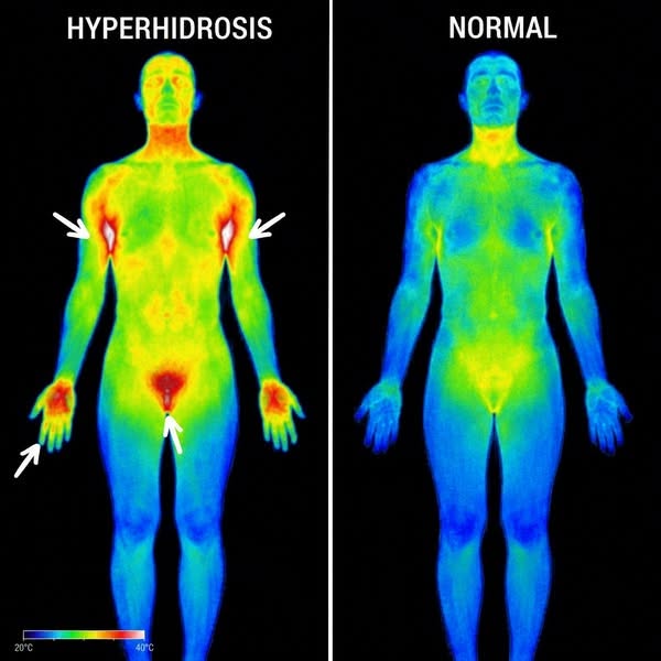 ​ Doctors keep missing this