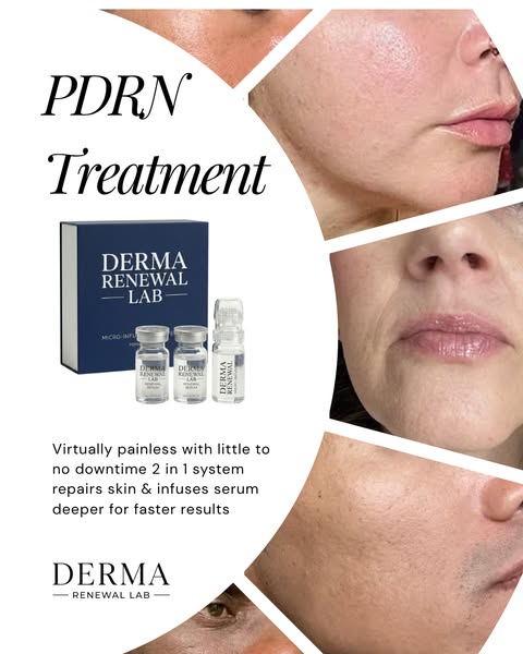 Fastest Way To Fade Acne Scars