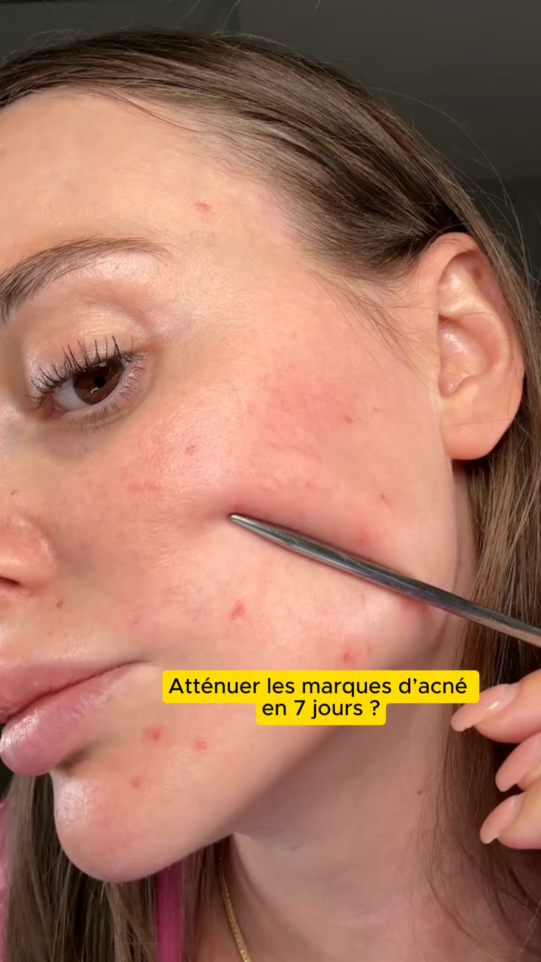 Taches atténuées en 7 jours