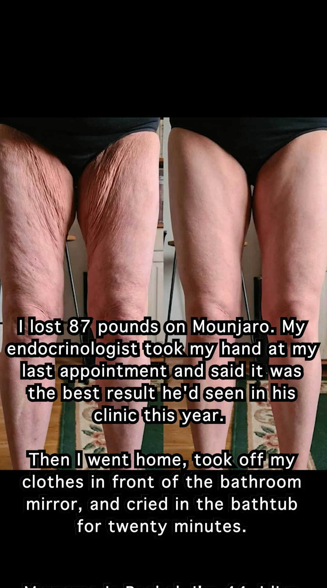 Say Goodbye to Creepy Skin