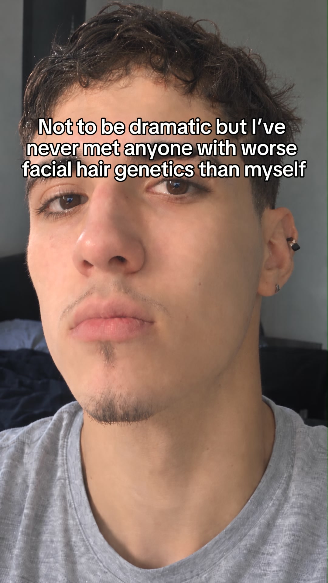 Put down the minoxidil bro