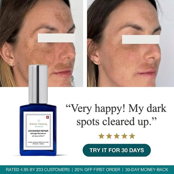 Sun Damage Fades Slower At 40