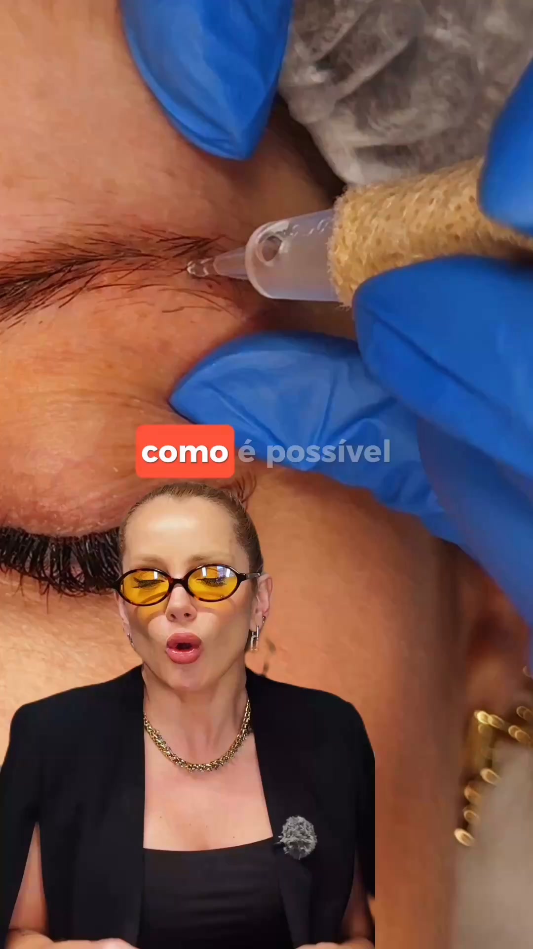 Exclusividade na estética