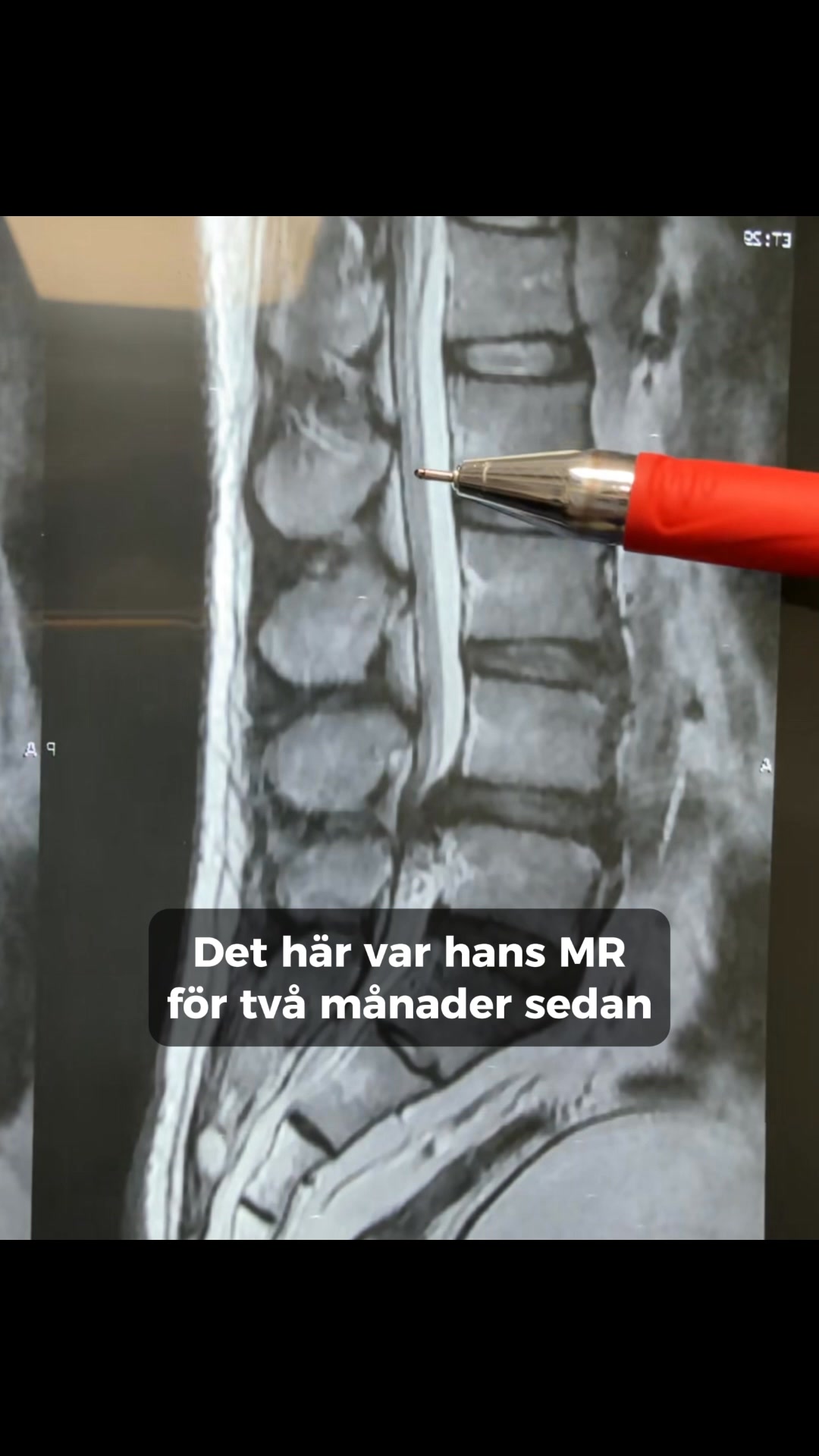 Ta första steget mot en smärtfri vardag