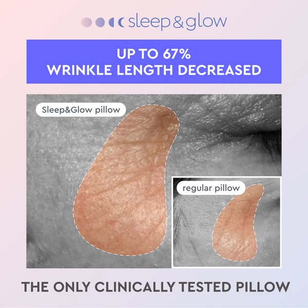 Anúncio de Sleep&Glow
