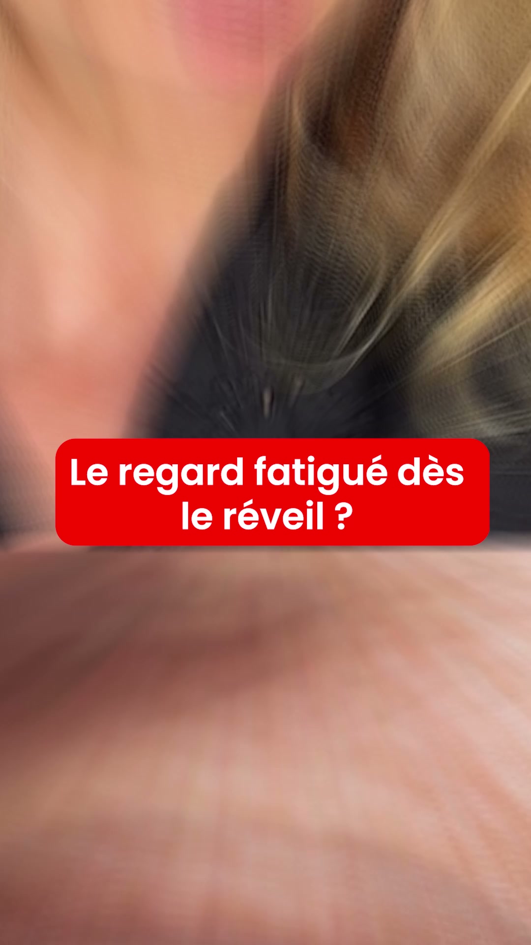 Découvrez le kit de micro-infusion Renovae
