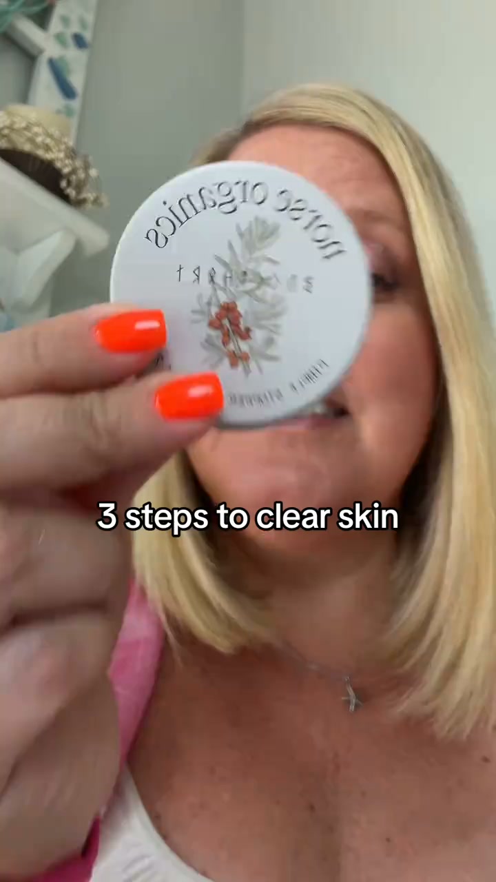 Fix Acne NOW!