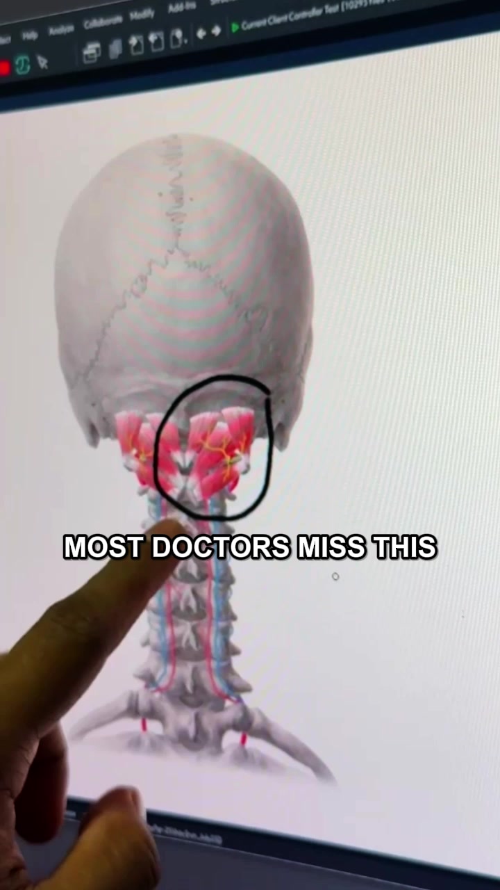Break Free From Neck Pain & Poor Posture