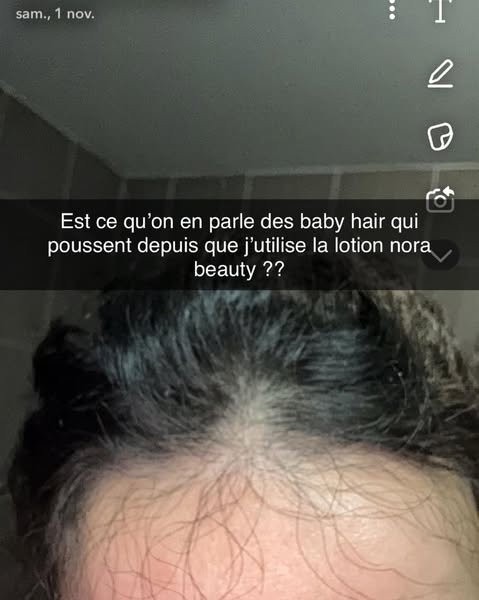 VIRAL - Lotion Sans Rinçage Pousse Extrême & Anti Chute de Cheveux - 1 – Nora Beauty