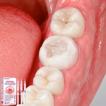 Cavity Repair FDA-Recognized 10% Nano-Hydroxyapatite (NH-10)| Delivery within 2-4 working days| Full refund guarantee
