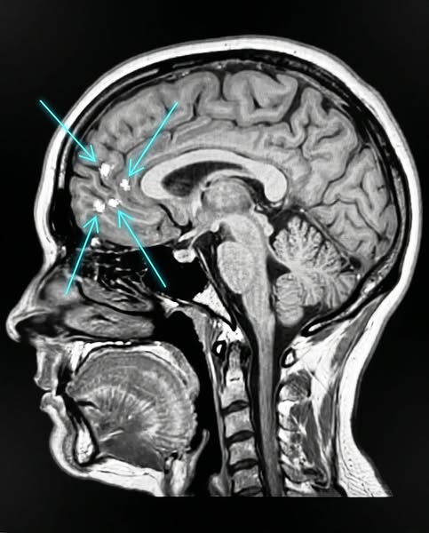 Migraines taking over your life? Read this