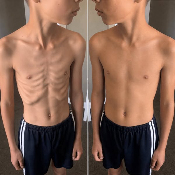 Mio figlio non era più sé stesso. Oggi è tutto diverso