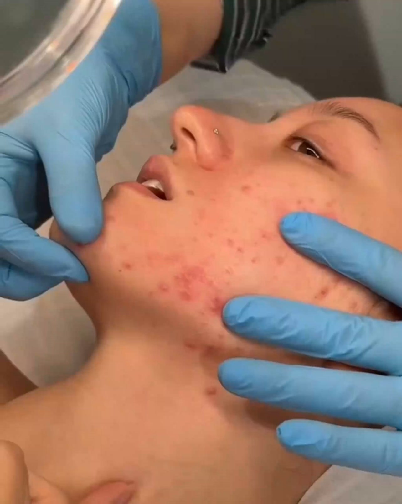 Clear & Healthy Skin