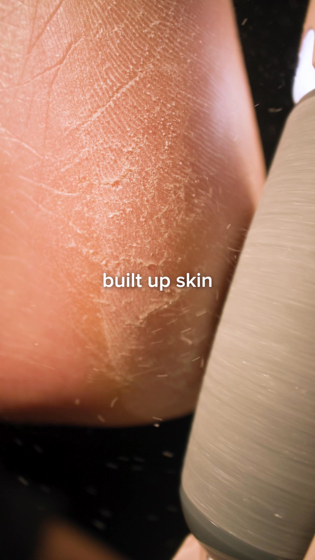 Smooth feet. In minutes. Guaranteed.