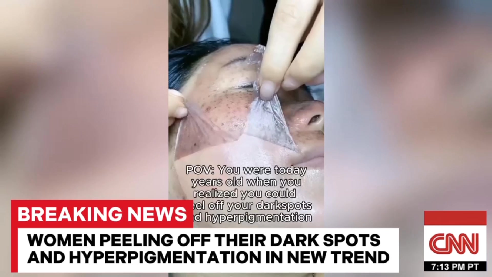 Natural skin transformation in weeks