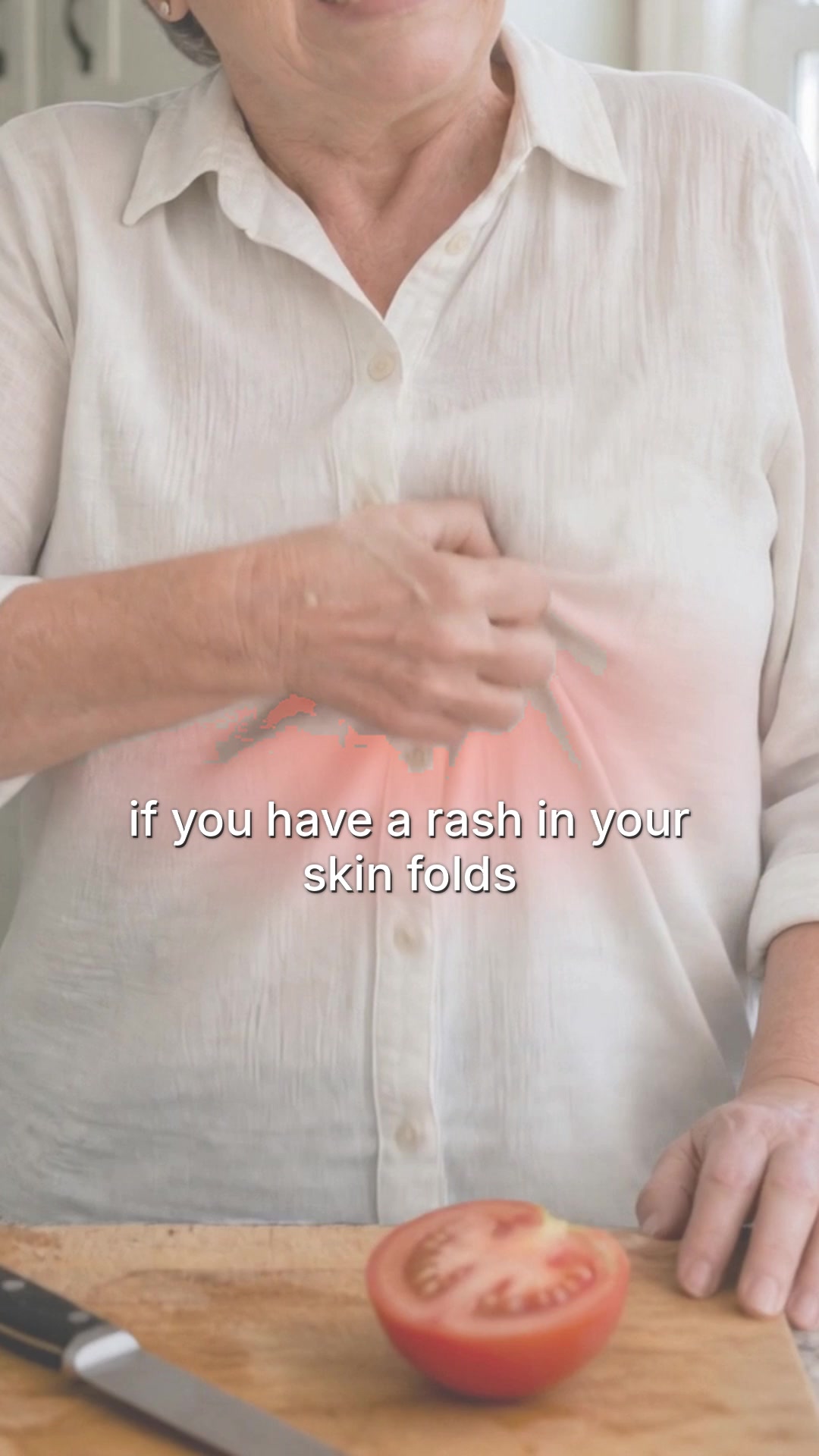 13 questions I hear every day about that rash under your breasts.