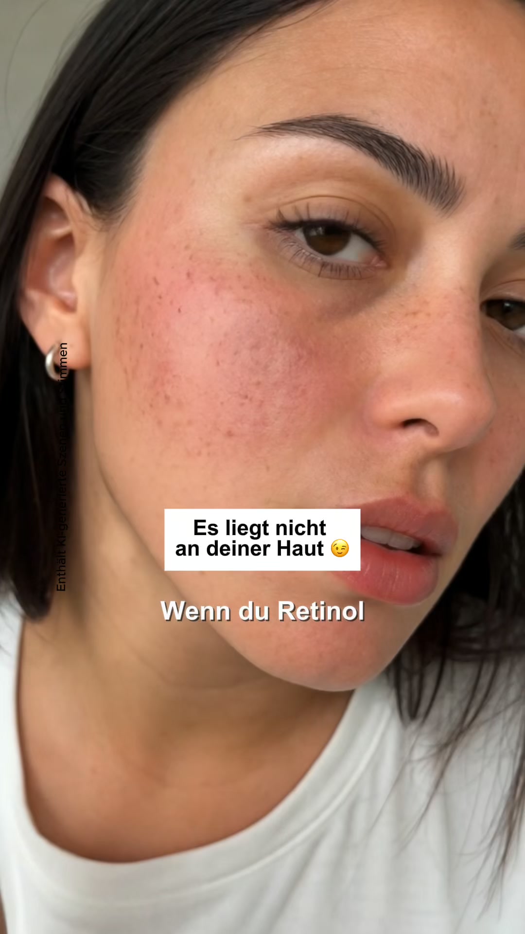 Nur für kurze Zeit: Gratis Milky Toner (100ml)