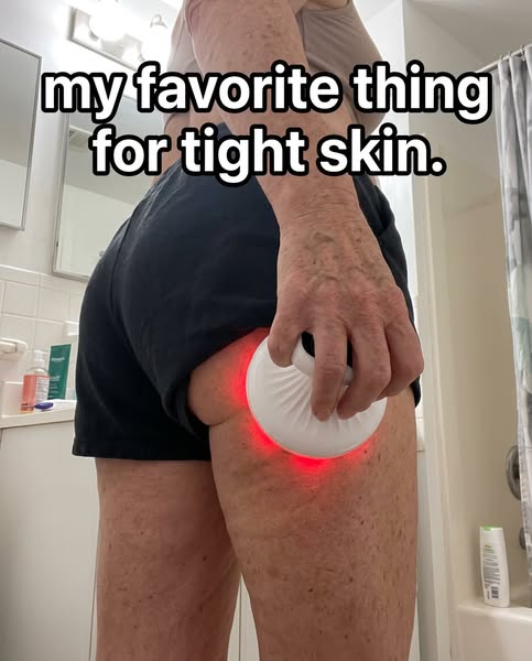 my skin is so tight