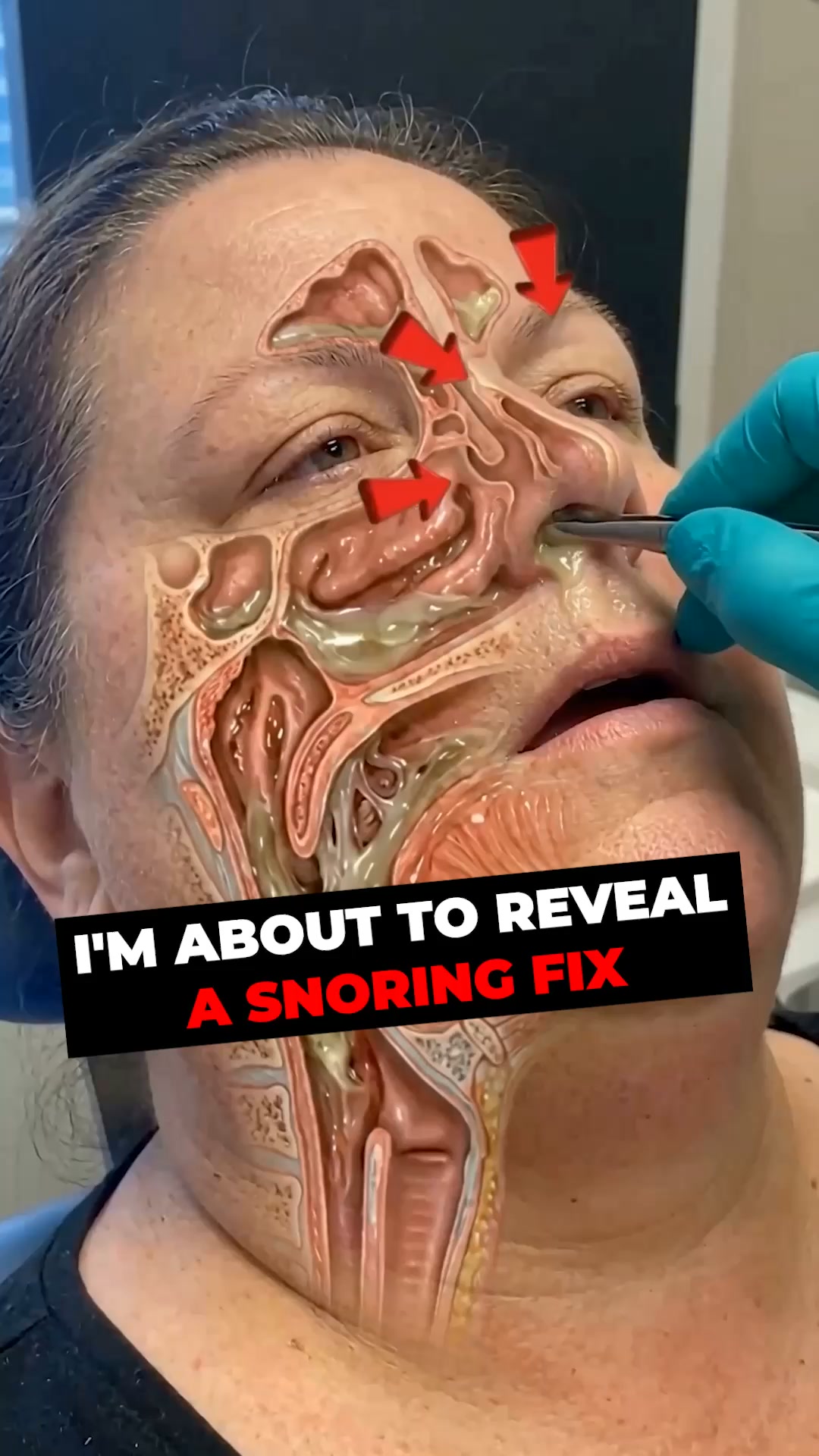 The Snoring Fix Made for Women
