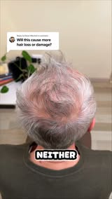 Seeing More Scalp Lately?