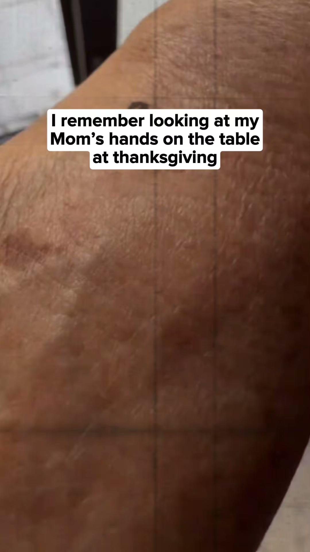 Let's talk about Age Spots.