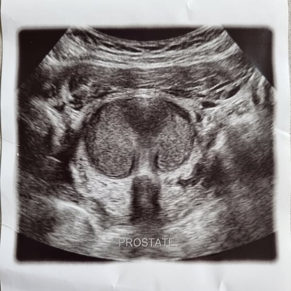 Urologists Are Trained To Prescribe Flomax. Not To Explain Why Your Gland Keeps Growing.