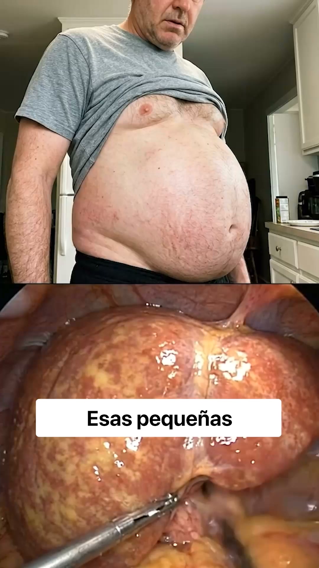 Cuida tu hígado — desde el interior