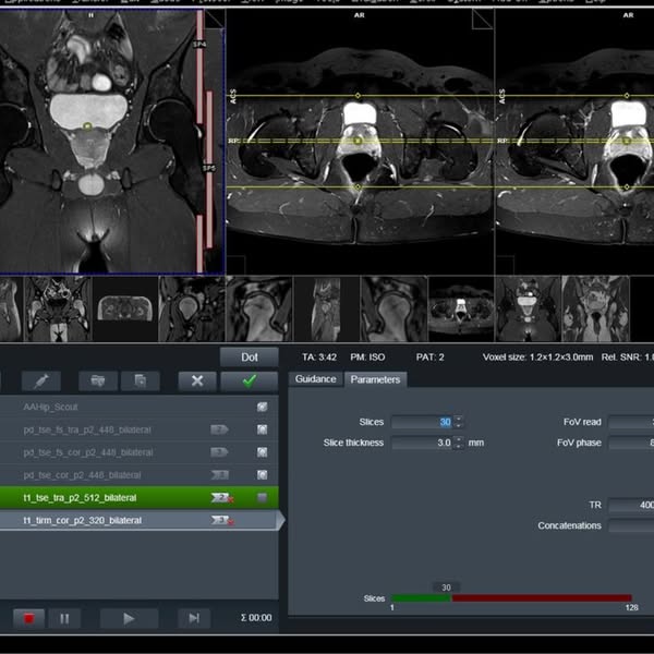 The Reason Your DEXA Numbers Won't Move