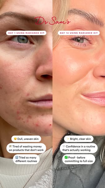 Unlock radiant skin in 2 weeks