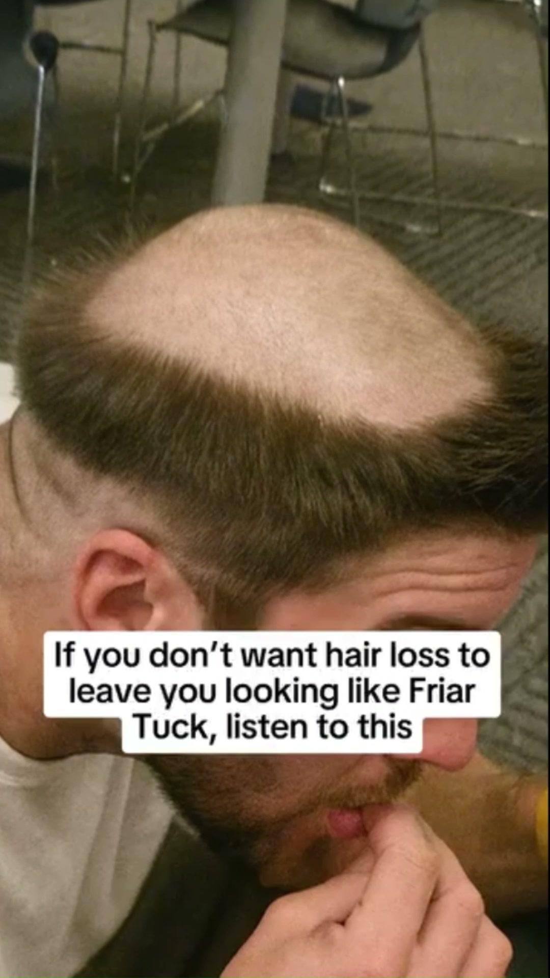 Take Control of Your Hair Growth (Without Drugs)