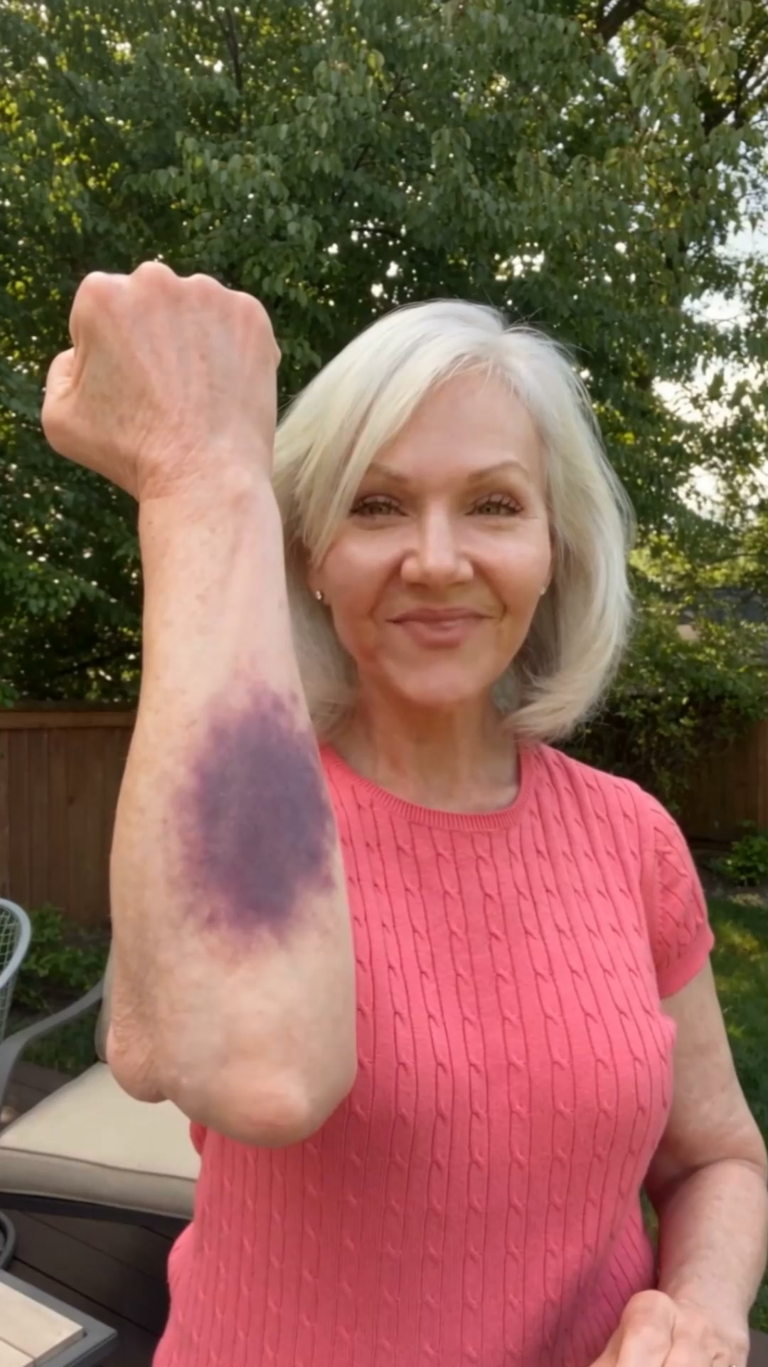 A slight bump shouldn't leave a mark for weeks.