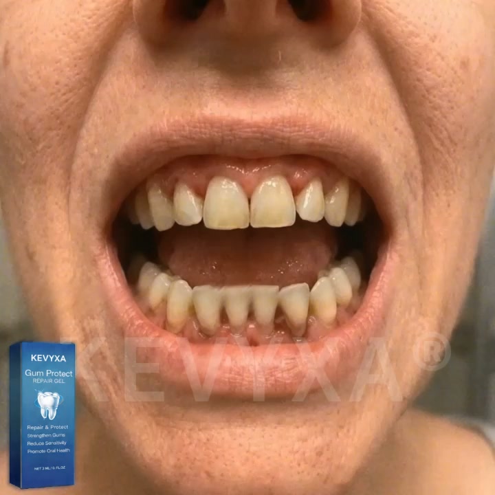 Tired of bleeding, receding gums? Relief is just one gel away!