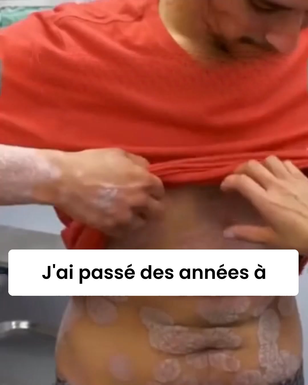 Le baume naturel qui met enfin un terme aux démangeaisons