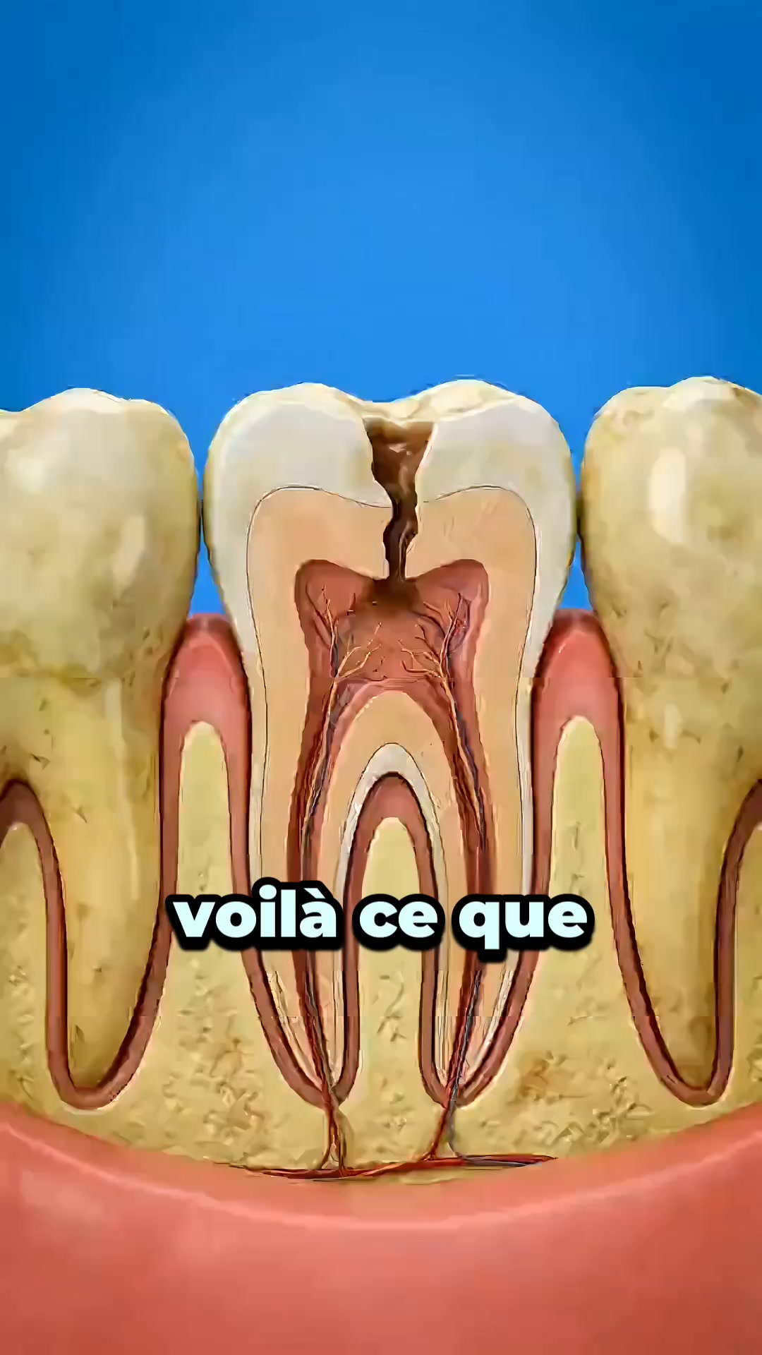 Cette solution simple contre le ronflement se vend comme des petits pains.