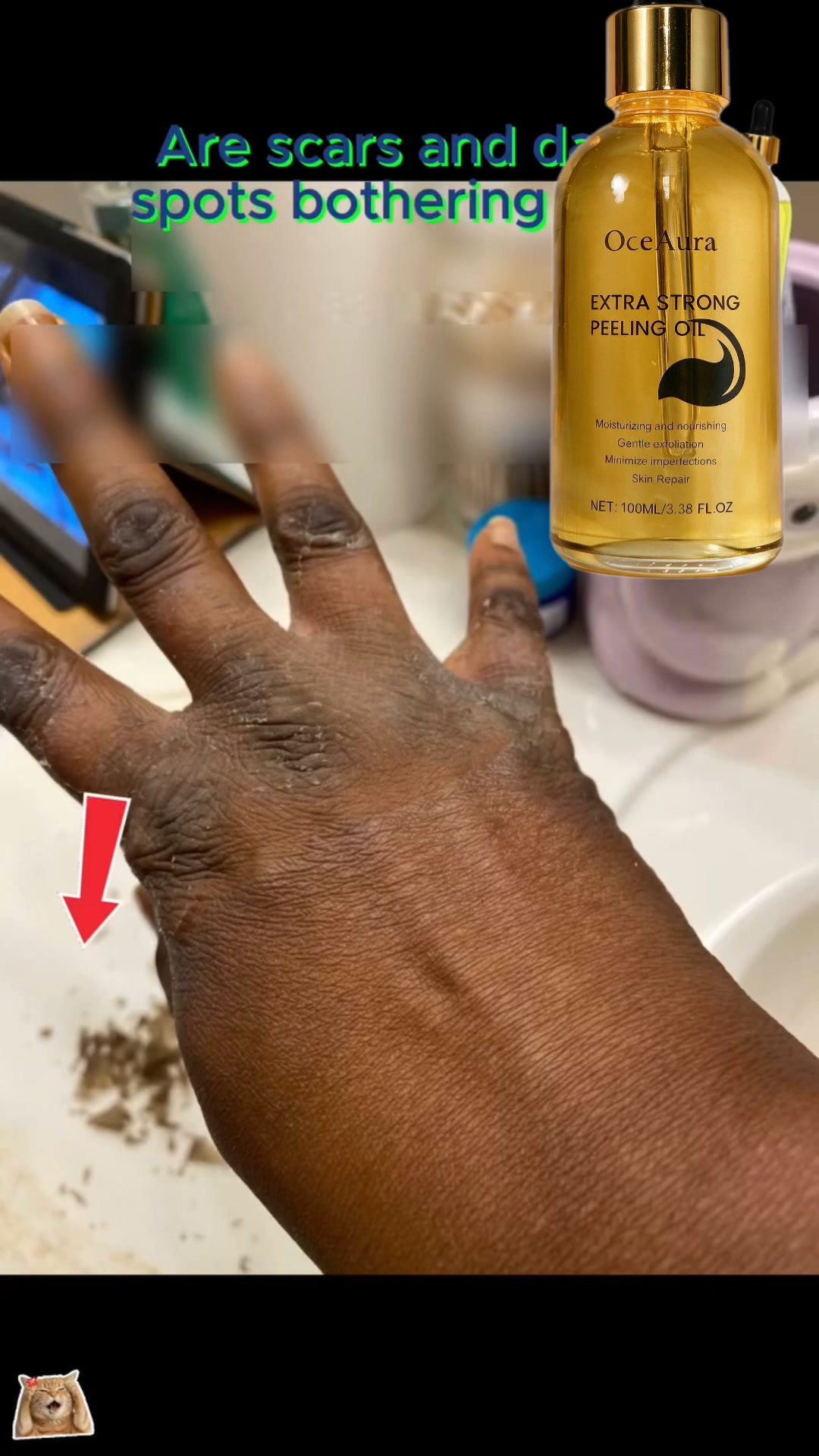 Are you tired of dealing with rough, dry and cracked skin on your hands?