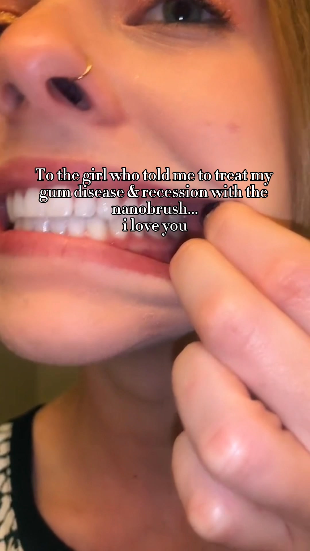 The First Sign of Gingivitis? Bleeding When You Brush.