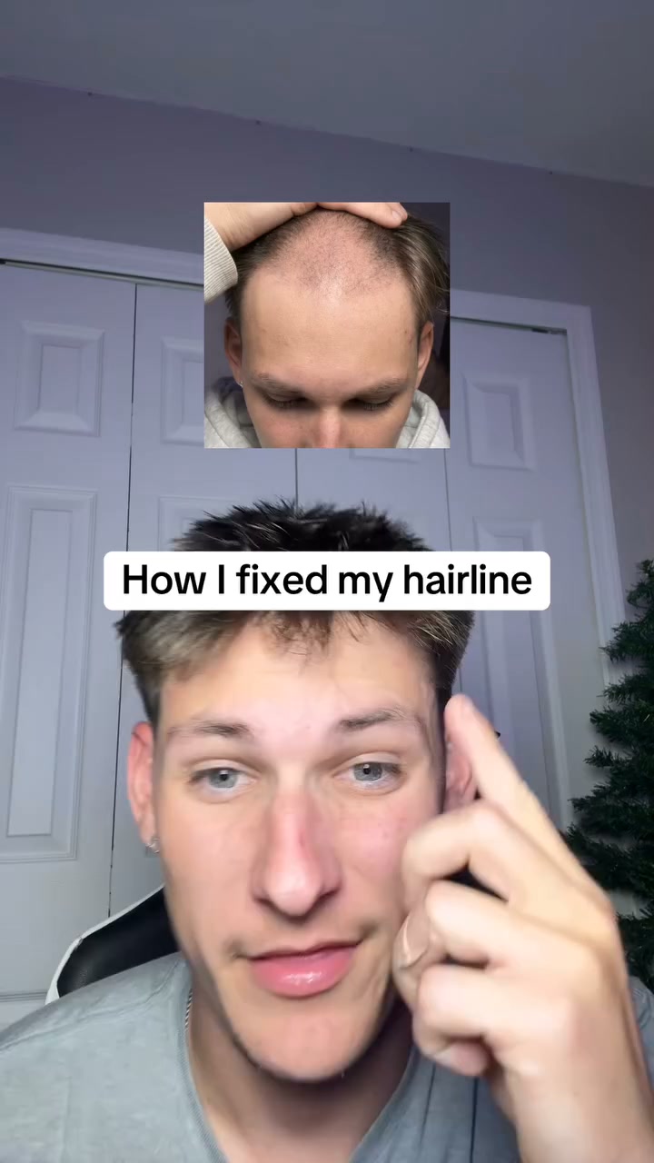 Regrow Hair Fast with AlphaInfuse
