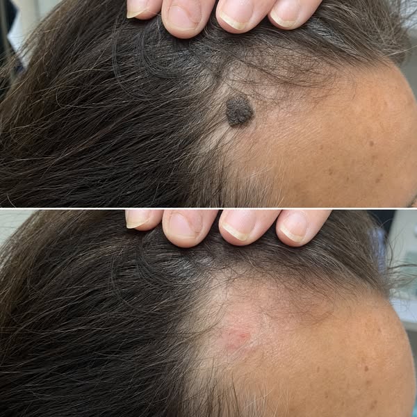 Read If Your Skin Barnacles Keep Multiplying