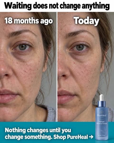 Dermatologists Stunned: The Whole-Plant Serum Doing What Acids, Lasers & $300 Creams Couldn't
