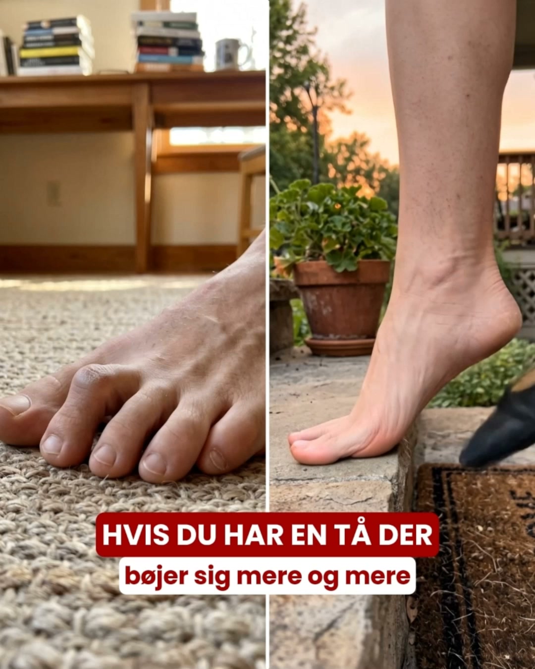 Giv hammertåen mere plads