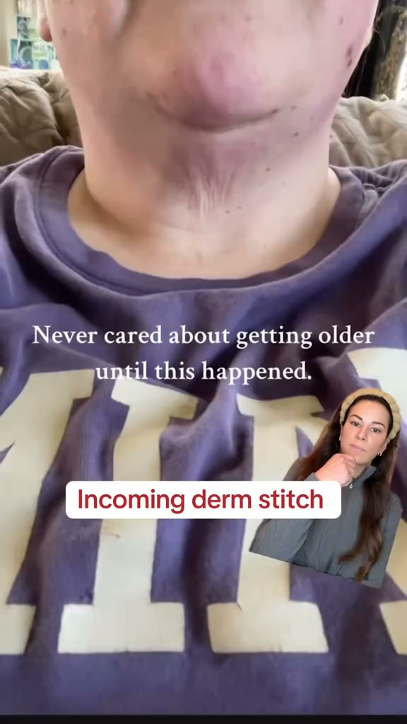 Tighten & Lift Crepey Neck Skin Fast