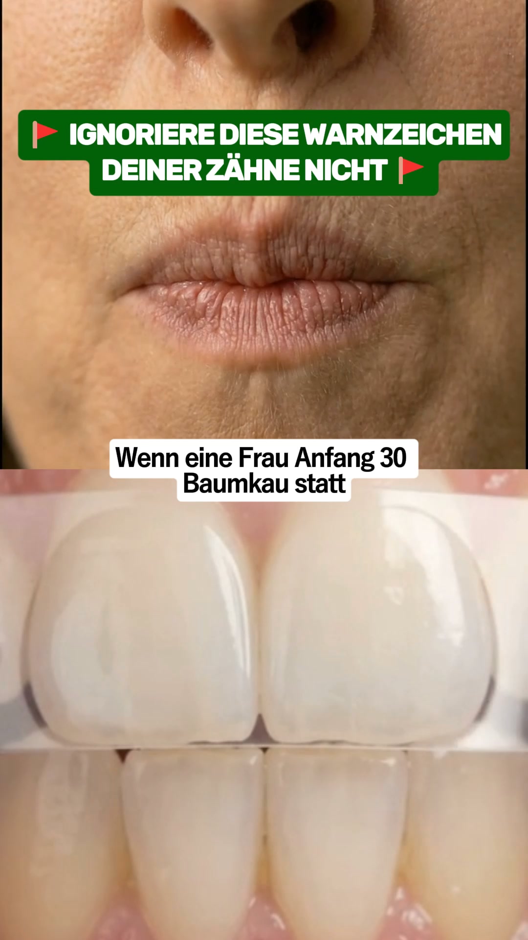 1 Kaugummi, der deine Zähne verändert.