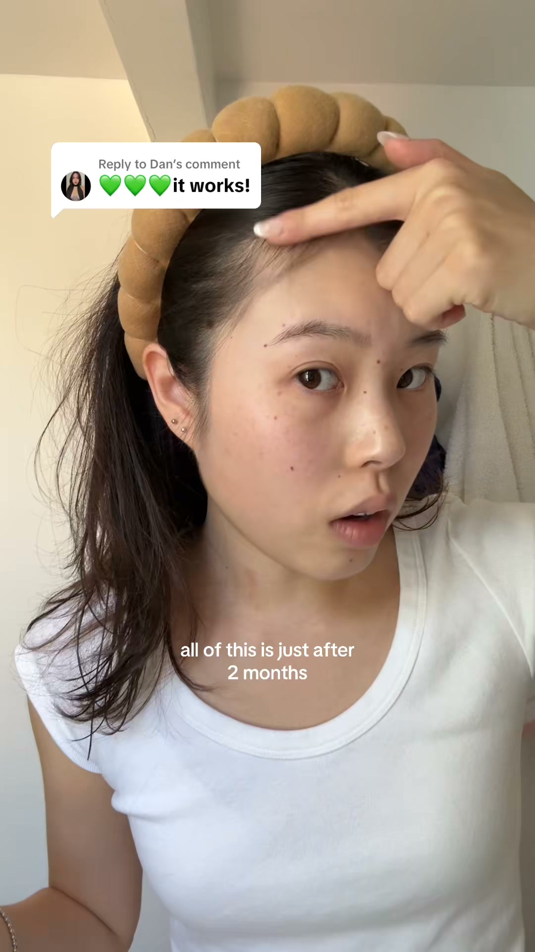 Korea's #1 Hair Growth Serum
