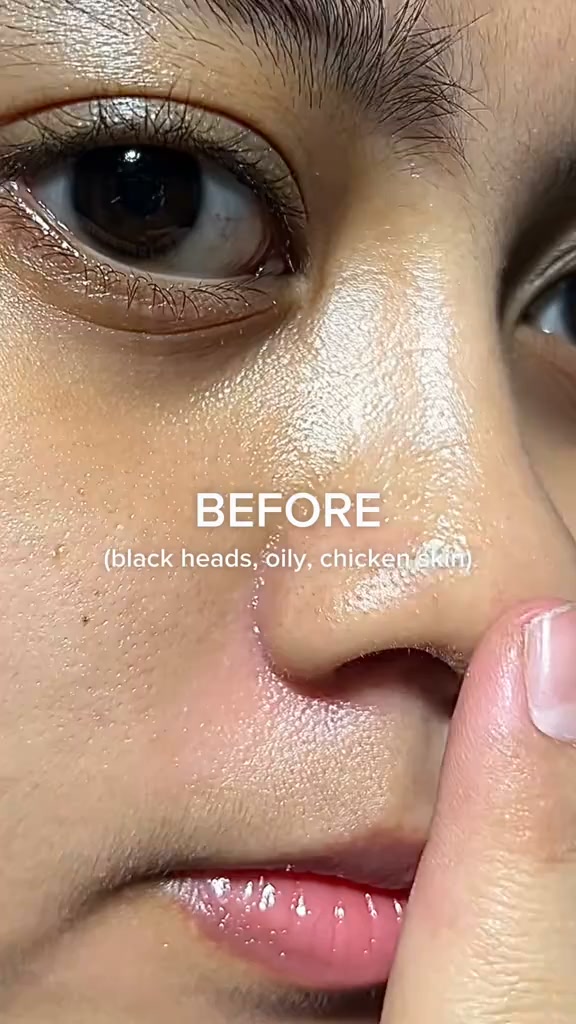 Brighter Skin Without Harsh Scrubs