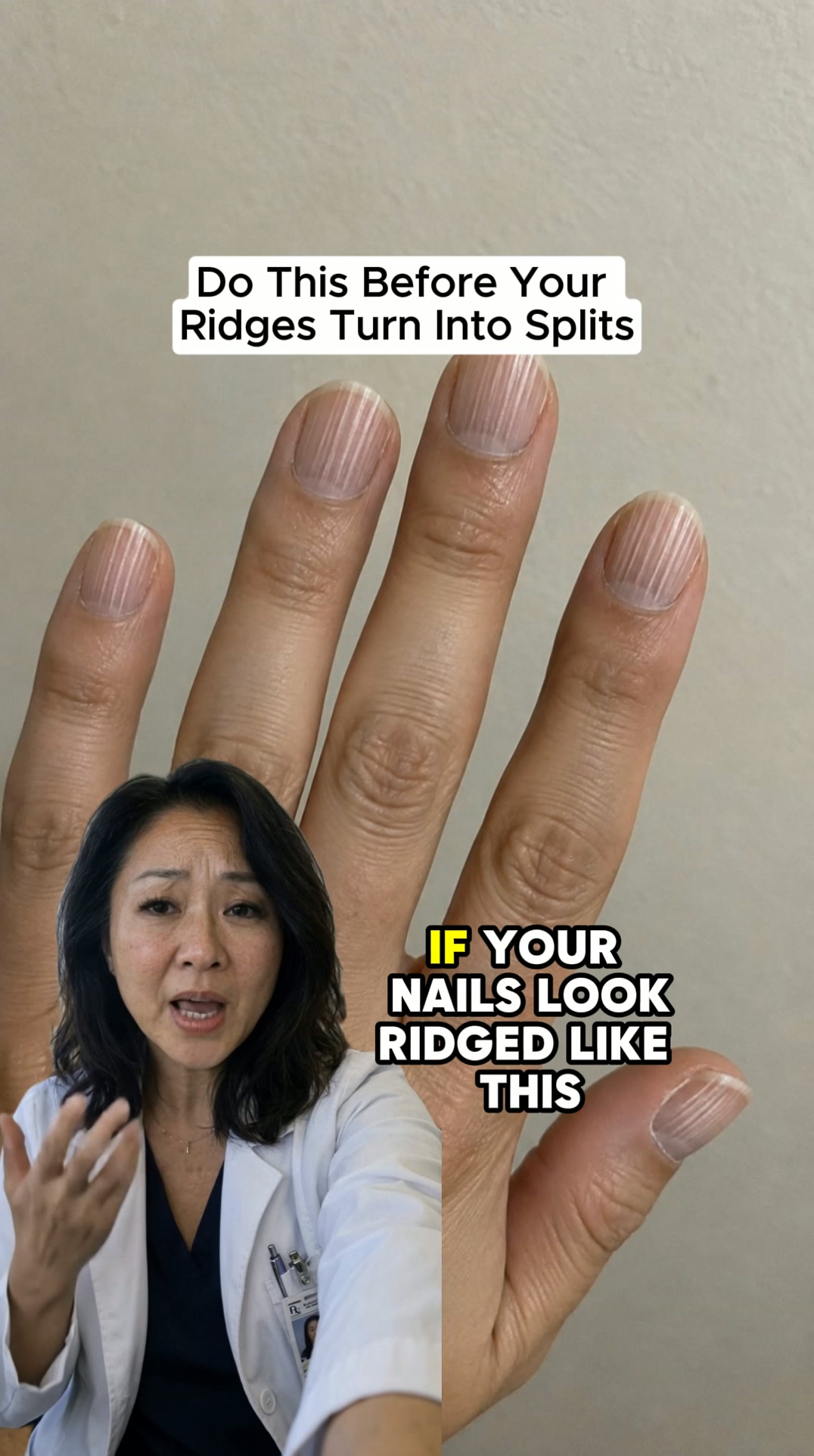 Why Nails Break After 50