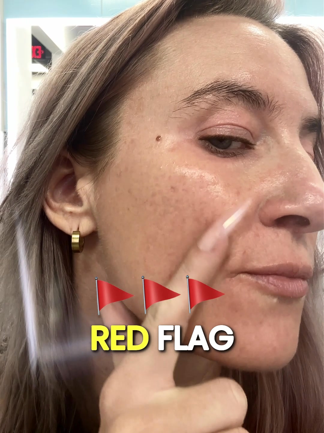 Still thinking about those fine lines?