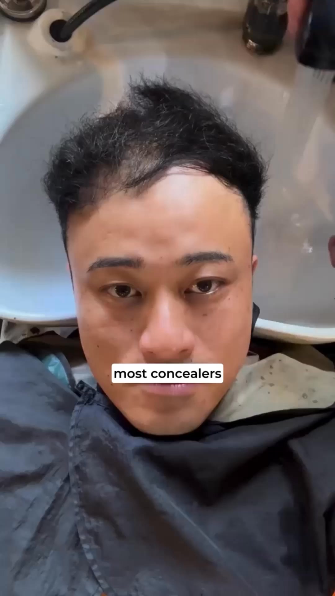 Instant Hair TransformationThat Lasts