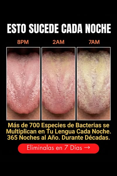 Mis piedras en las amígdalas pasaron por 6 etapas — yo me enteré en la 4